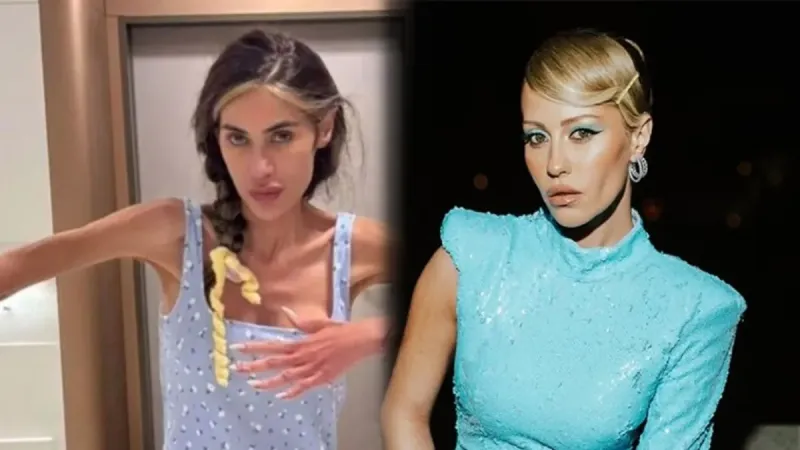 2 yıl mücadele etmiş! Derya Uluğ'dan "anoreksiya" itirafı! 1 dilim ekmek yiyebilmek için...