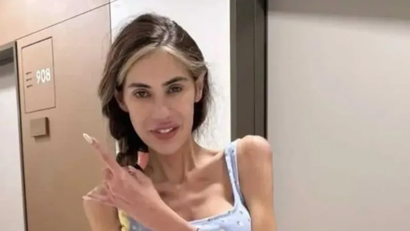 Anoreksiyadan hayatını kaybeden Nihal Candan'ın acılı babası konuştu: Şöhret dünyasına girince sapıttı