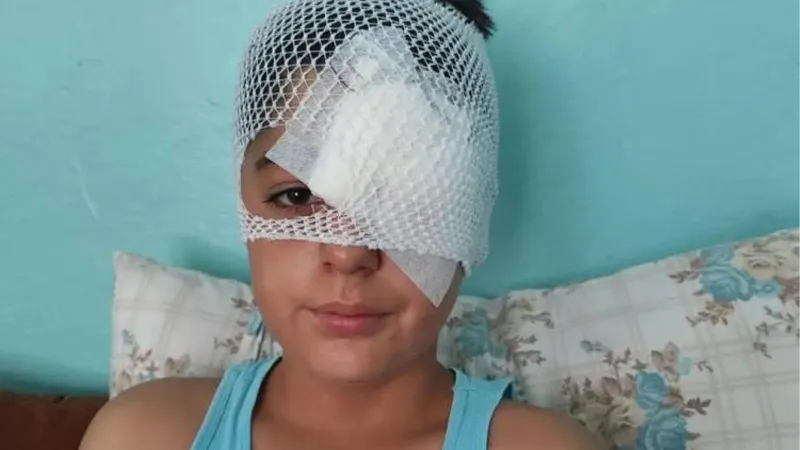 Şanlıurfa'da köpek saldırısından kaçarken otomobilin çarptığı çocuk hastaneye kaldırıldı